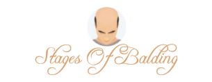 Stages Of Balding Logo