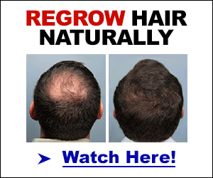 cowlick or balding treatment