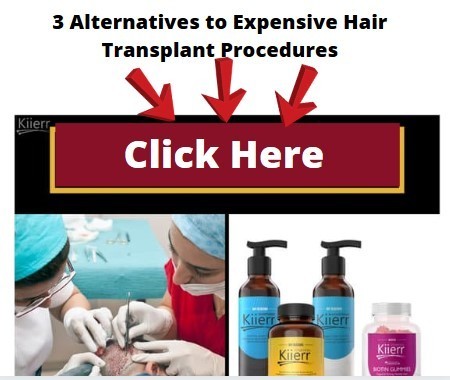 3 Alternatives to Expensive Hair Transplant Procedures
