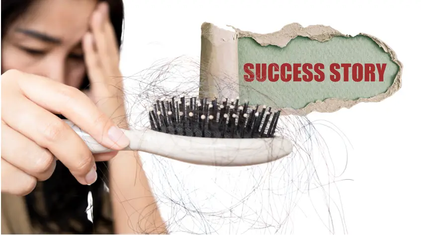 Female Pattern Hair Loss Success Stories