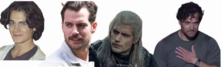 Henry Cavill's hairline transformation over the years