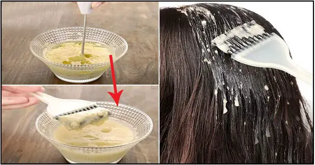 how to remove dandruff permanently from hair