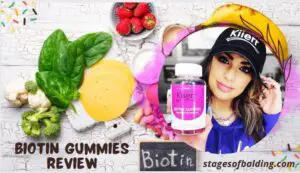 Biotin Gummies Review