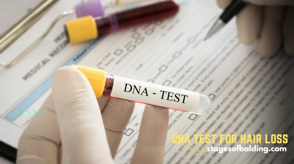DNA Test for Hair Loss