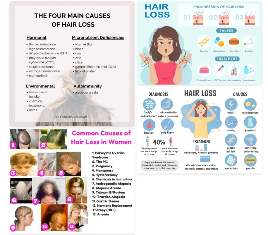 According to multiple sources, Native shampoo does not cause hair loss, the image shows what are the common causes of hair loss.