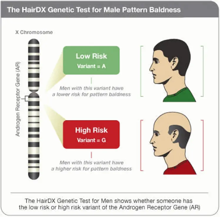 Trichotest Genetic Test for Hair Loss and Alopecia