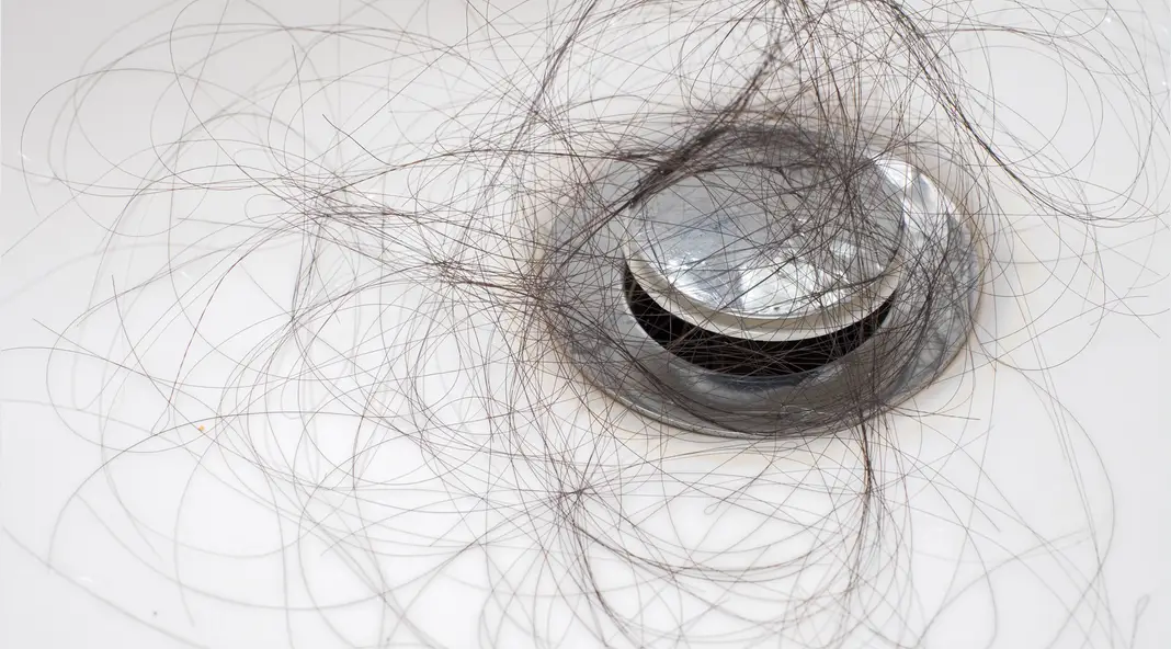 how much hair is normal to lose in shower