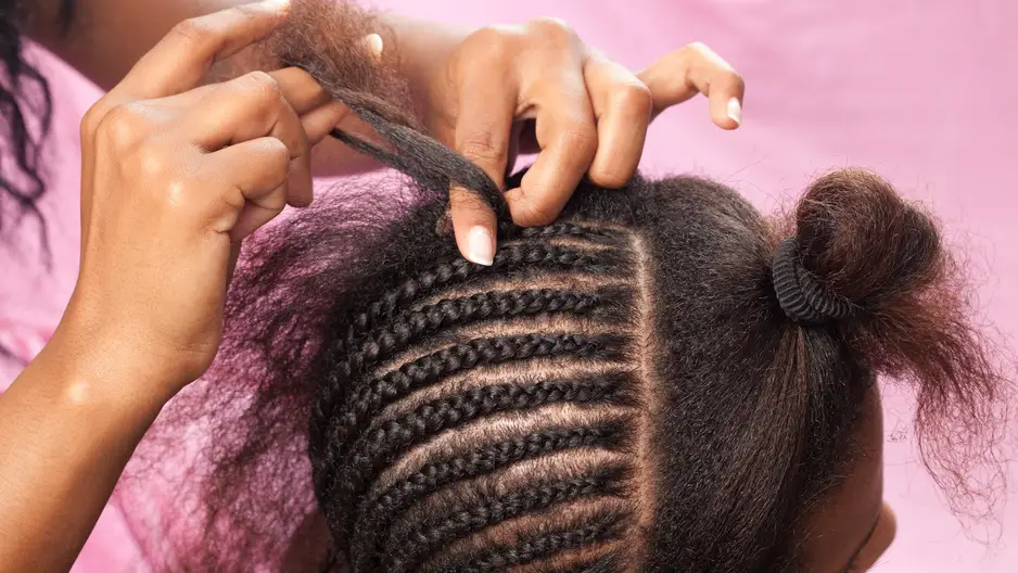 traction alopecia hair extensions