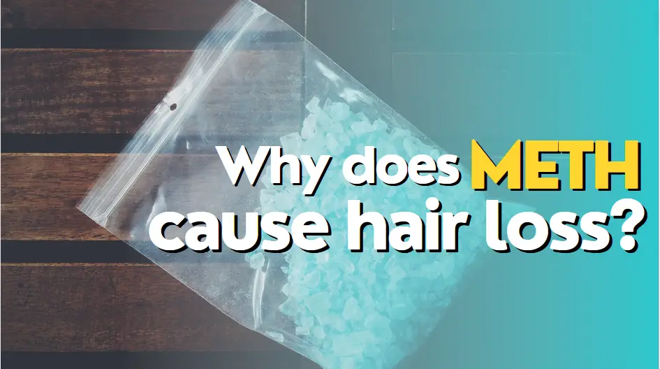 Does Meth Cause Hair Loss