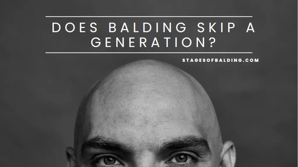 Does Balding Skip a Generation