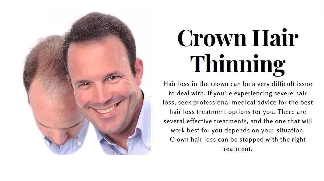 Crown Hair Thinning