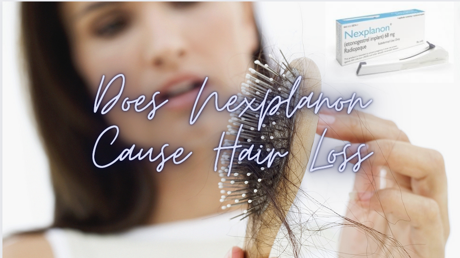 Does Nexplanon Cause Hair Loss
