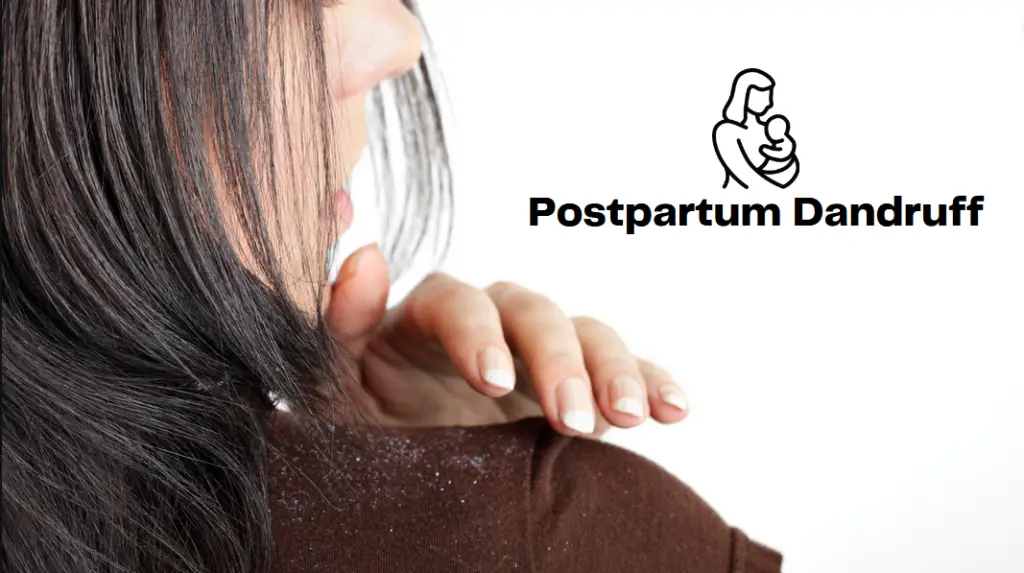 Postpartum Dandruff