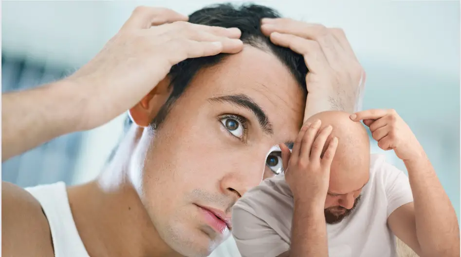 Receding Hairline vs Balding