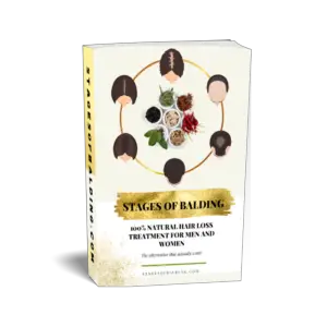 Stages of Balding Treatment for Men and Women eBook