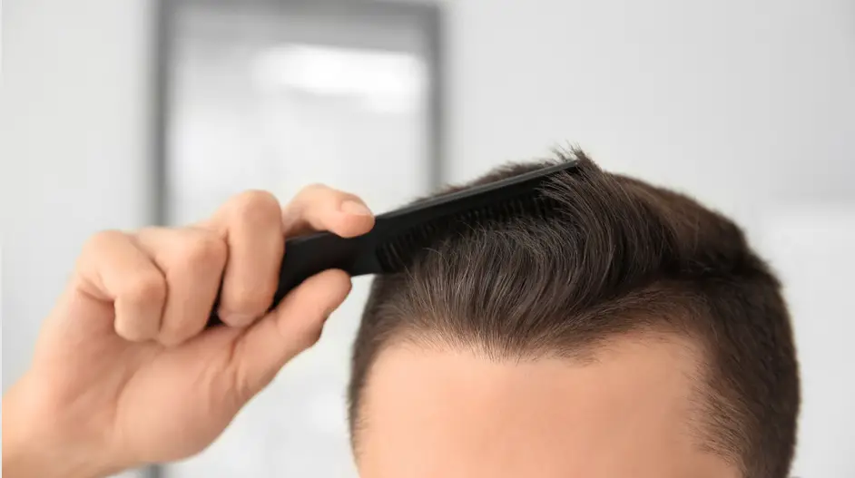 Thinning Hair At The Temples And Forehead