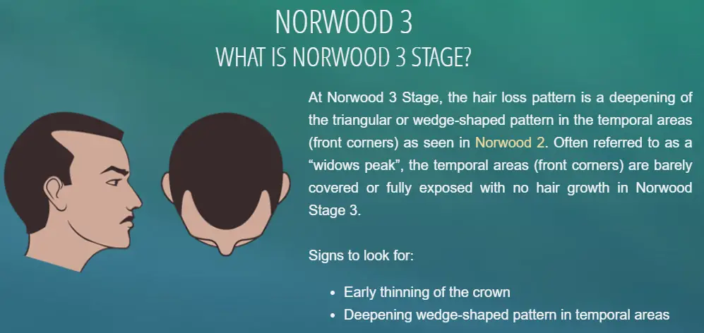 What is Norwood 3 