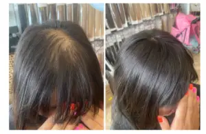 Hair Extensions for Balding Crown