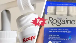 Keeps vs Rogaine