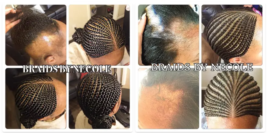 Camouflage Braids for Alopecia Hair