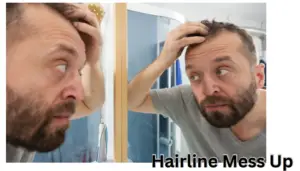 Hairline Mess Up