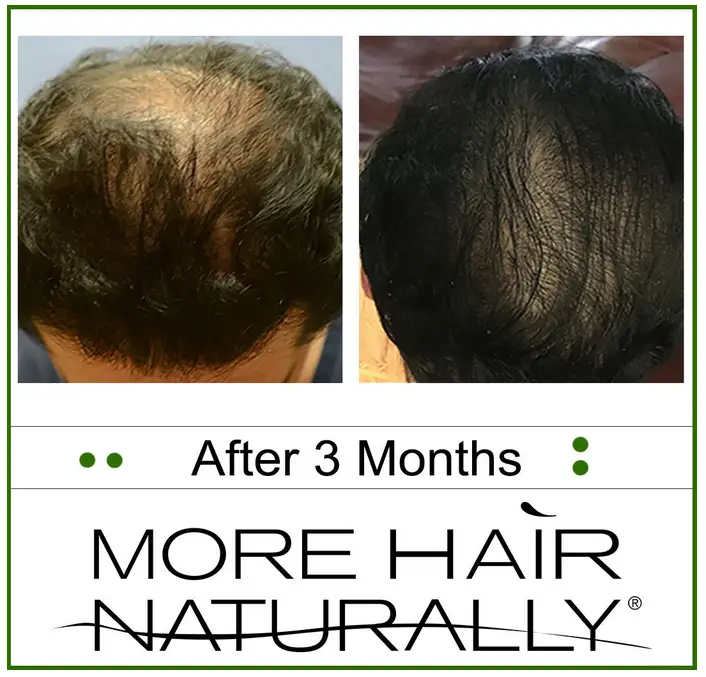 More hair naturally reviews before and after