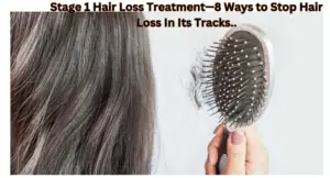 Stage 1 Hair Loss Treatment