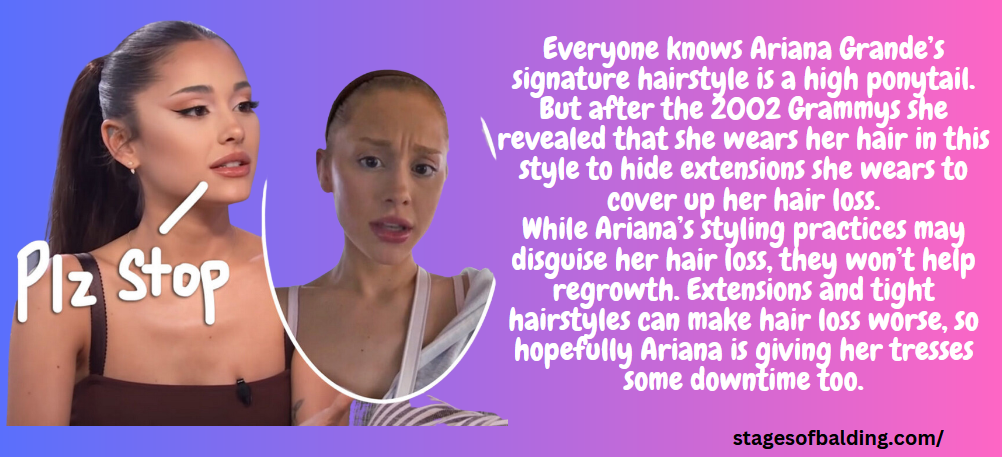 Ariana Grande's a female celebrities with hair loss