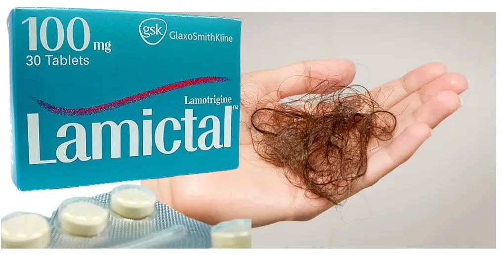 Does Lamictal Cause Hair Loss