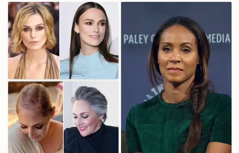 Early Stage Celebrity Female Hair Loss