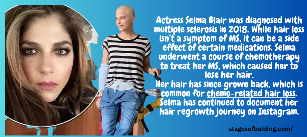 Selma Blair debuts shaved head as she battles Multiple Sclerosis