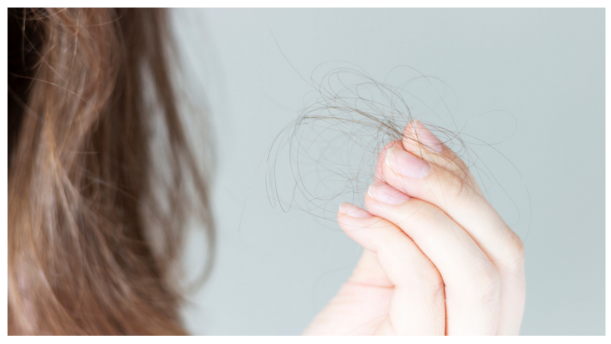 Illustration of hair strands falling out, indicating hair loss.