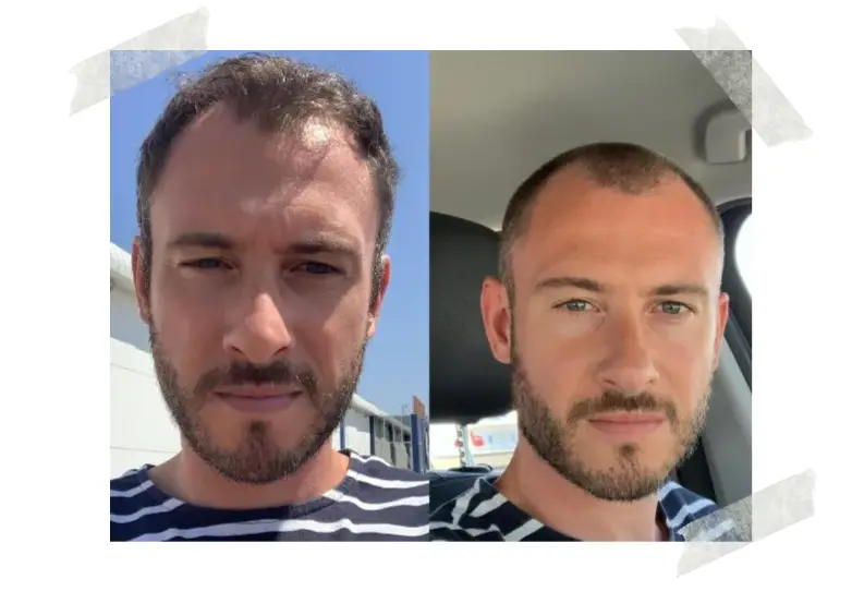 Before and After Buzz Cut