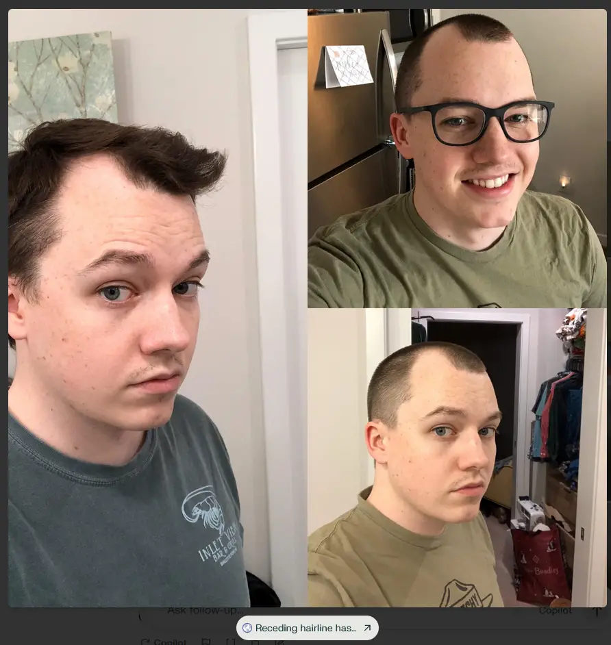 Buzz Cut Receding Hairline Before and After Reddit