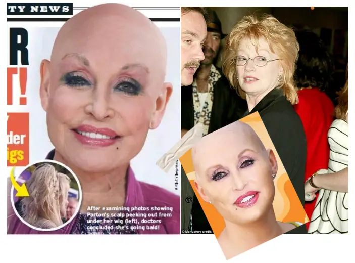 Dolly Parton Without Wig