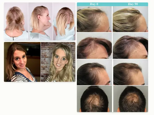 Viviscal Pro Shampoo Reviews of Happy Customer Showing Thick Hair After Using Viviscal Pro Shampoo
