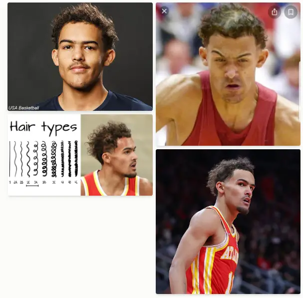 A close-up photograph of Trae Young with his distinctive hairline that extends past the regular boundaries.