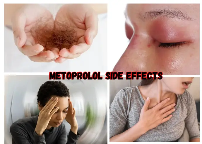 Illustration of a person experiencing various side effects of Metoprolol, including hair loss