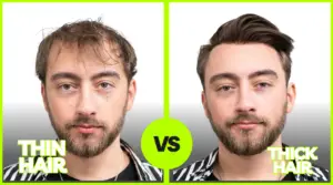 Thin Hair vs Thick Hair Male