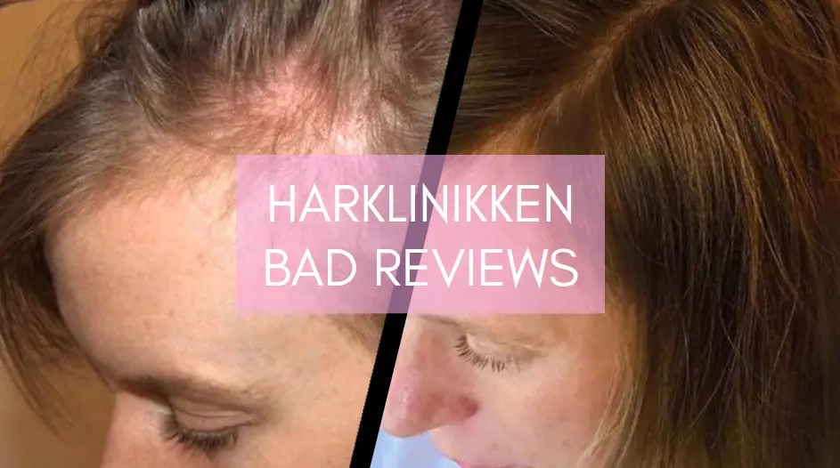 Harklinikken Bad Reviews