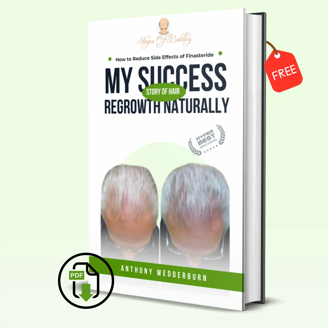 BALDING CROWN EBOOK